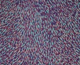 Kearsley NSW Melbourne Tourism